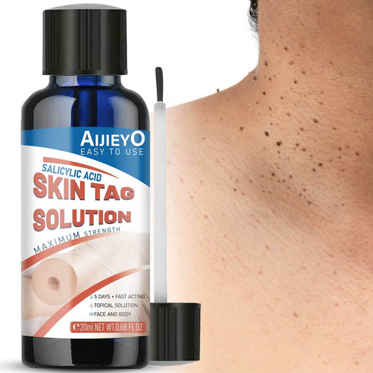 Fast-Acting Salicylic Acid Skin Tag Remover - Instant Revitalization for Hands, Elbows, Face and Feet - Gentle and Safe for All Skin Types