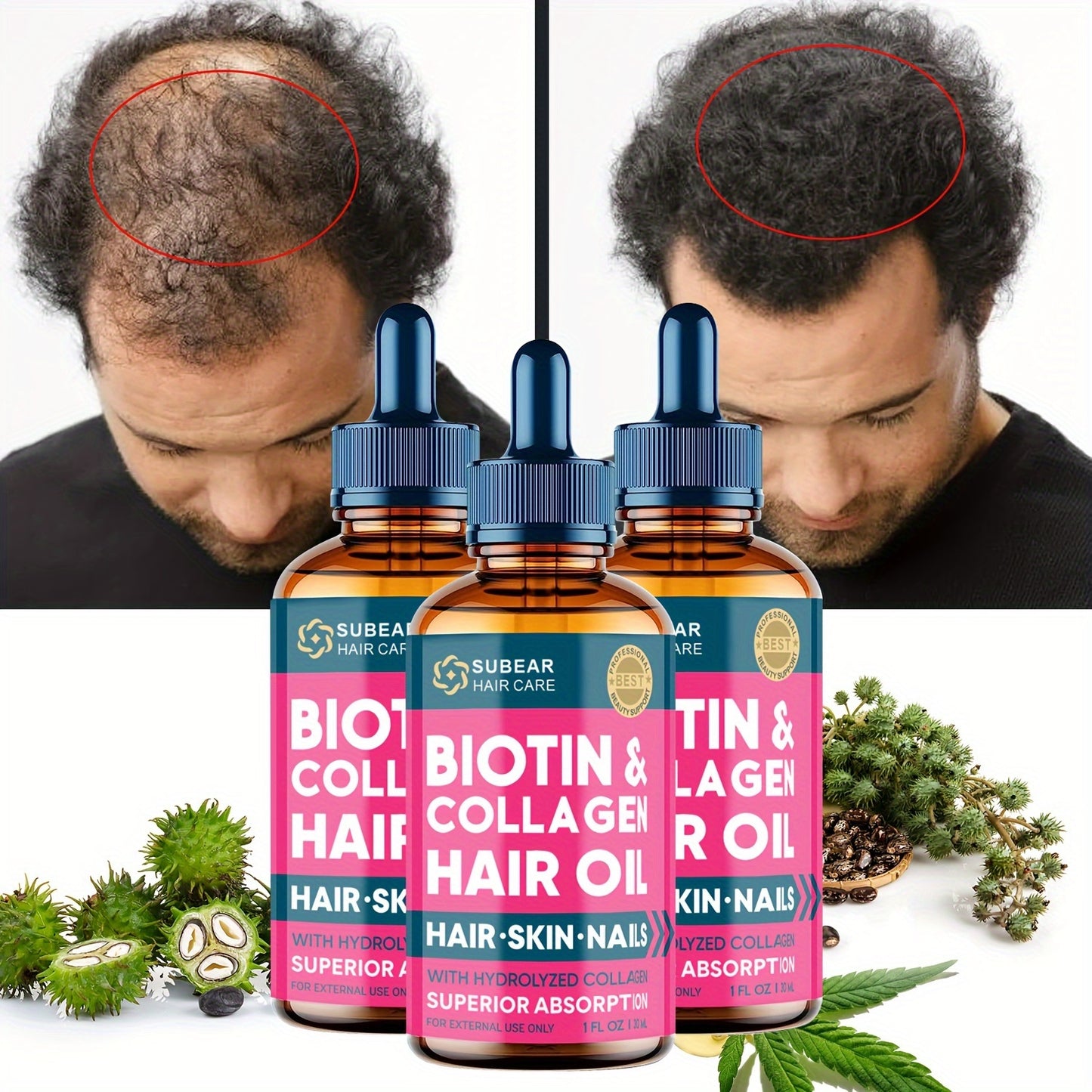 Biotin Hair Growth Serum - Thickening Oil for Thin, Damaged, and Frizzy Hair, Healthier Scalp for Men and Women, 1 Fl Oz