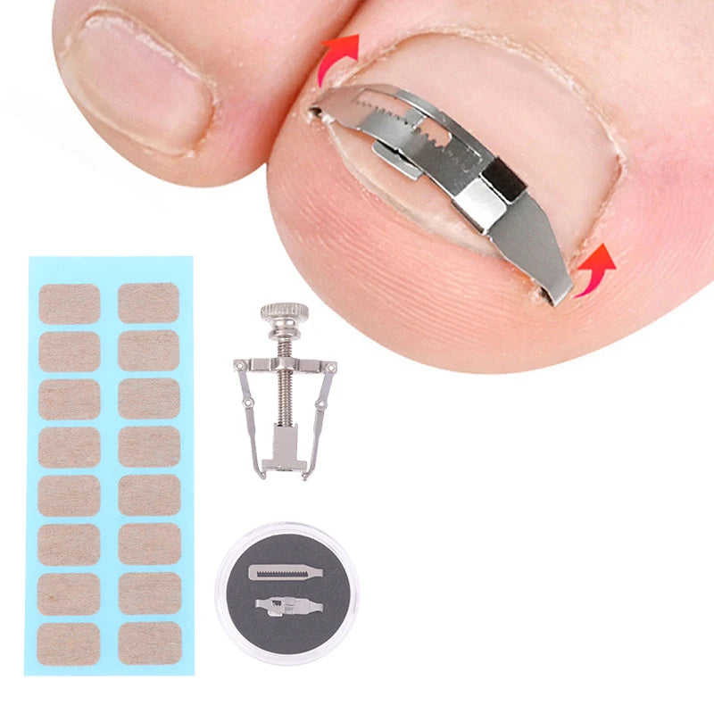 Pedicure Ingrown Toenail Corrector Tool - Professional Toe Nail Treatment for Foot Care Correction and Recovery