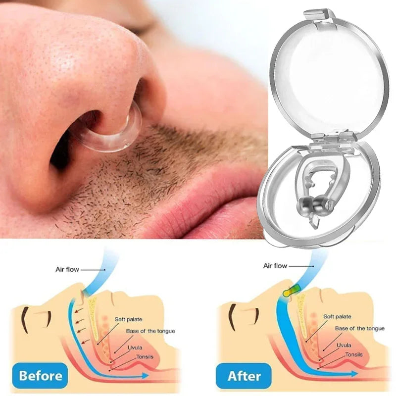 Anti-Snoring Corrector – Snore Prevention Nose Clip for Women & Men – Sleep Aid Device for Nighttime Snore Elimination