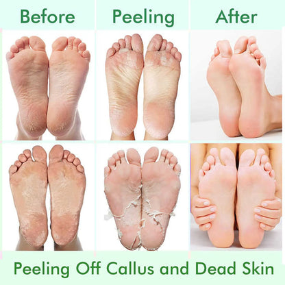 Lavender Foot Peel Mask - Exfoliator for Removing Calluses and Dead Skin, Ideal for Dry Cracked Feet