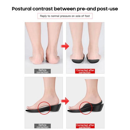 Orthopedic Insoles for Flat Feet - Arch Support Pads for Shoes | Unisex Foot Care Inserts (1 Pair)