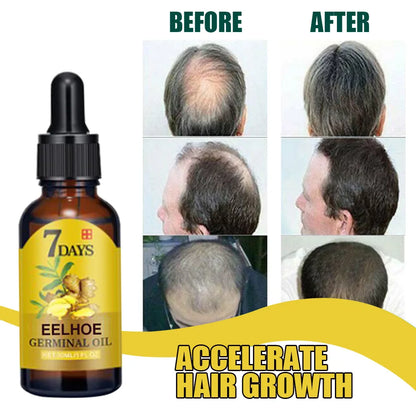 Ginger Hair Growth Serum - Anti-Hair Loss and Fast Regrowth Treatment - Repair Oil for Damaged Hair and Scalp for Women and Men