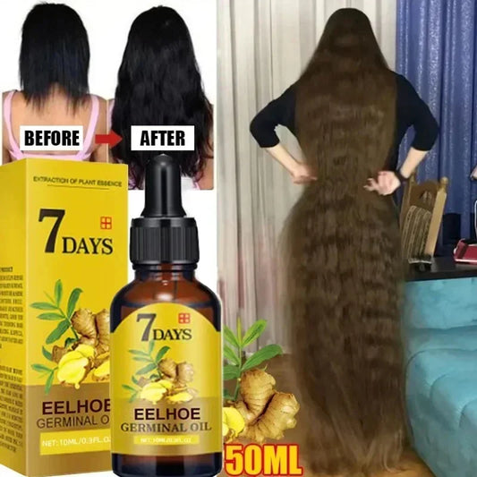 Ginger Hair Growth Serum - Anti-Hair Loss and Fast Regrowth Treatment - Repair Oil for Damaged Hair and Scalp for Women and Men