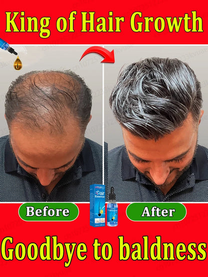 2024 Expert-Approved Hair Growth Essential Oil - Effective Baldness Repair and Hair Restoration