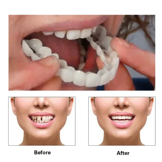 Perfect Fit Snap-On Silicone Smile Veneers - Teeth Whitening Fake Tooth Cover, Upper False Tooth for Oral Hygiene Care