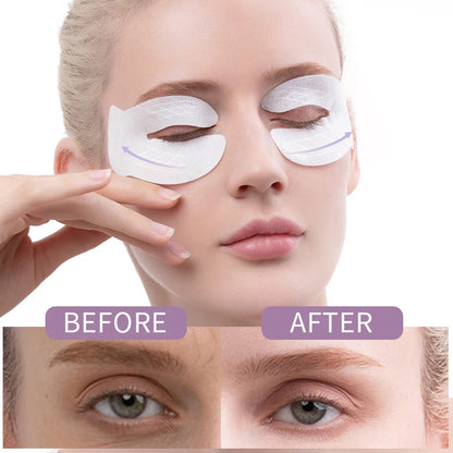 ILISYA C Cycle Anti-Wrinkle Eye Patches | Dark Circles & Wrinkle Removal | Hydrating Moisturizing Eye Mask