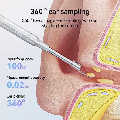 3.9mm Digital Otoscope: Smart Visual Ear Cleaning Tool with 4.3 Inch Display - 30MP Type-C, Connects to Computer, 2600mAh Battery