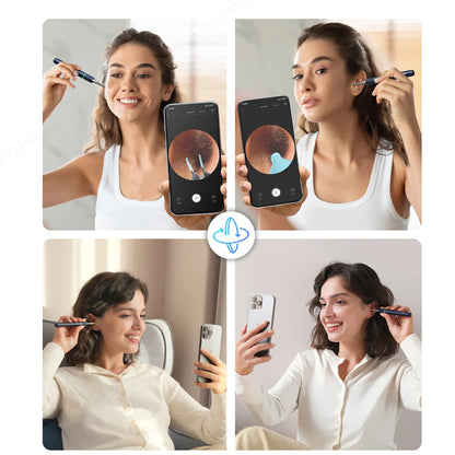 Bebird Note5 Pro Ear Cleaner: Smart Visual Ear Wax Removal Tool with Endoscope Tweezers and Mini Camera - Personal Health Care Solution