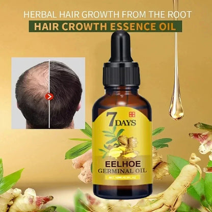 Fast Hair Growth Oil: Ginger Hair Treatment for Men & Women - Anti Hair Loss Scalp Serum, Beauty Health Product