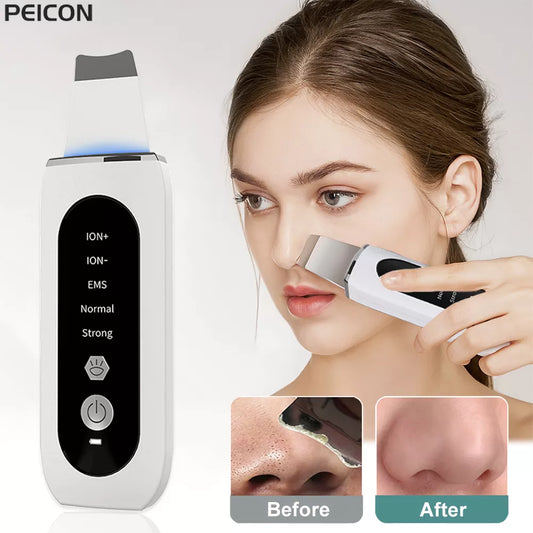 Ultrasonic Skin Scrubber: Blackhead Remover & Deep Face Cleaning Ion Acne Pore Cleaner - Facial Shovel Cleanser