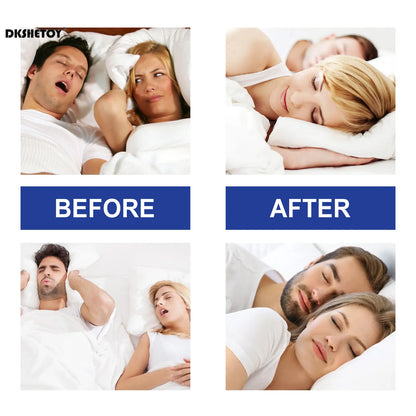 30pcs Anti-Snoring Mouth Tape: Nighttime Sleeping Aid for Improved Breathing - Reduce Dry Mouth and Promote Nose Breathing, Health Care Solution