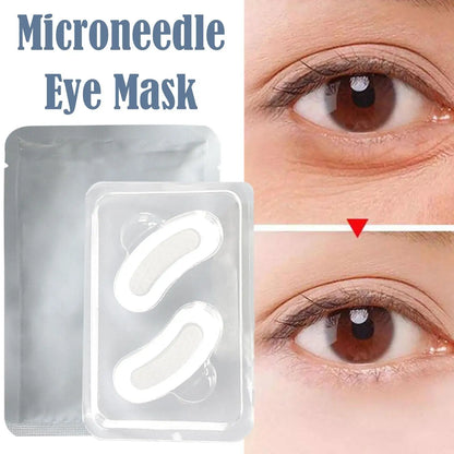 Hyaluronic Acid Microneedle Eye Patches Mask | Anti-Wrinkle, Anti-Aging, Dark Circles, Moisturizing Under Eye Gel Pads | Skin Care Solution