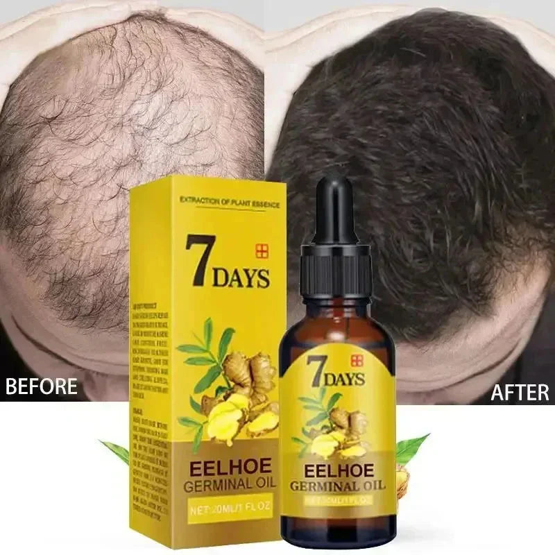 Ginger Hair Growth Serum - Anti-Hair Loss and Fast Regrowth Treatment - Repair Oil for Damaged Hair and Scalp for Women and Men