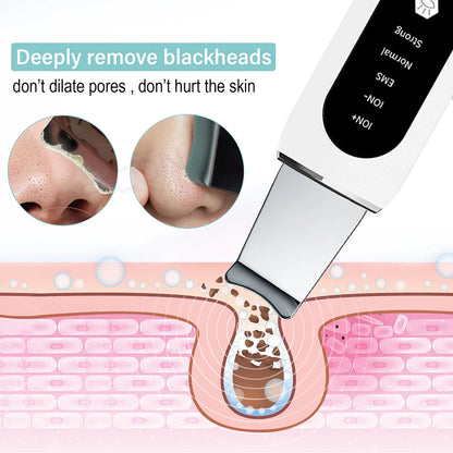 Ultrasonic Skin Scrubber: Blackhead Remover & Deep Face Cleaning Ion Acne Pore Cleaner - Facial Shovel Cleanser