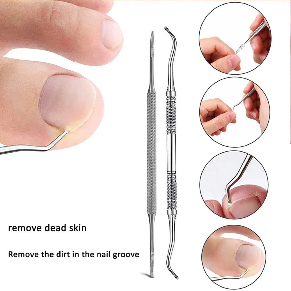 Ingrown Toenail Correction Patch Stickers Set - Pedicure Tool for Toe Nail Treatment and Foot Care