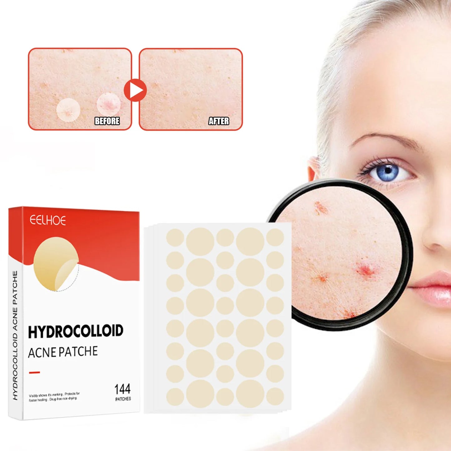 144pcs/set Acne Pimple Patch - Invisible Face Skin Care with 2 Sizes, Professional Healing and Absorbing Spot Stickers for Men and Women