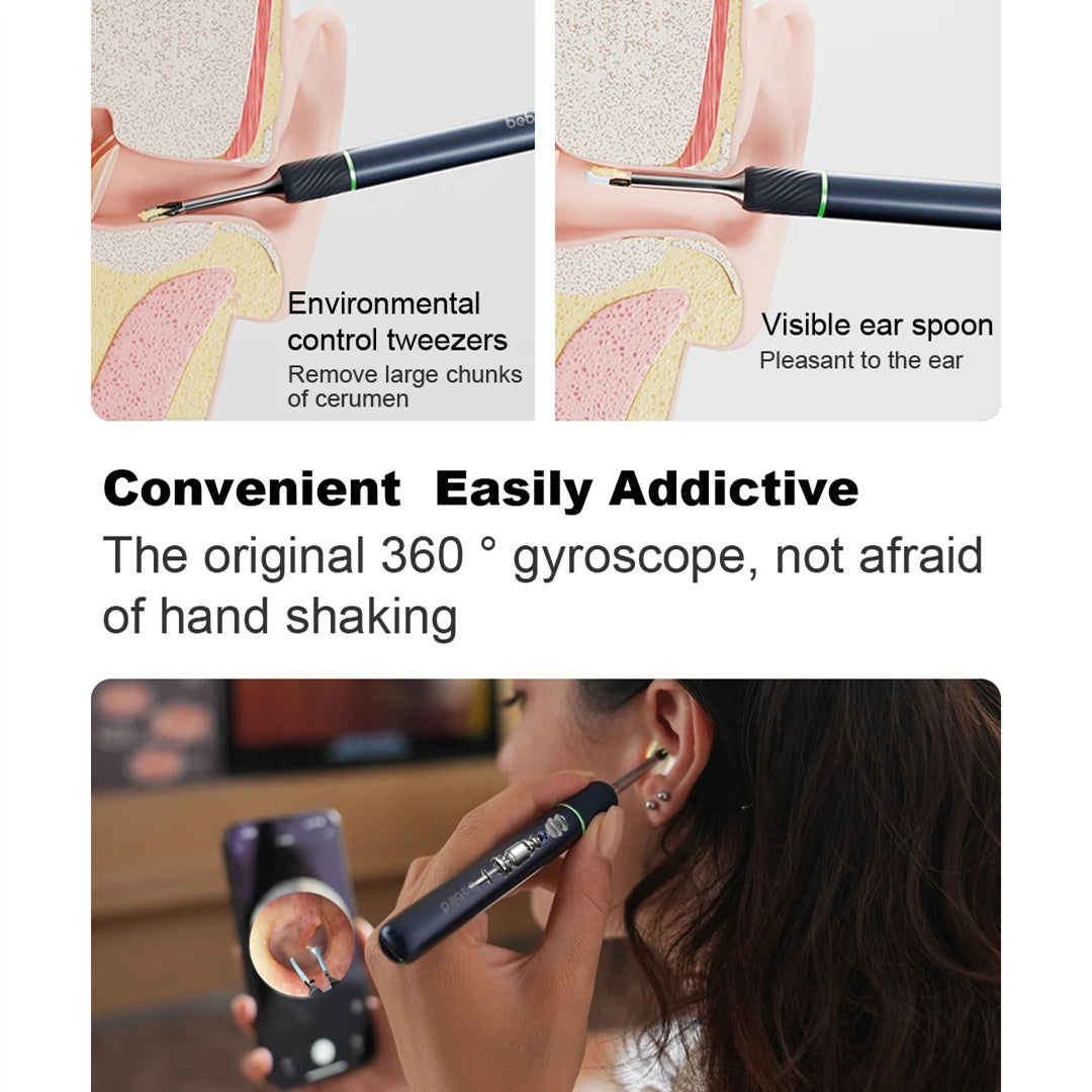 Bebird Note5 Pro Ear Cleaner: Smart Visual Ear Wax Removal Tool with Endoscope Tweezers and Mini Camera - Personal Health Care Solution