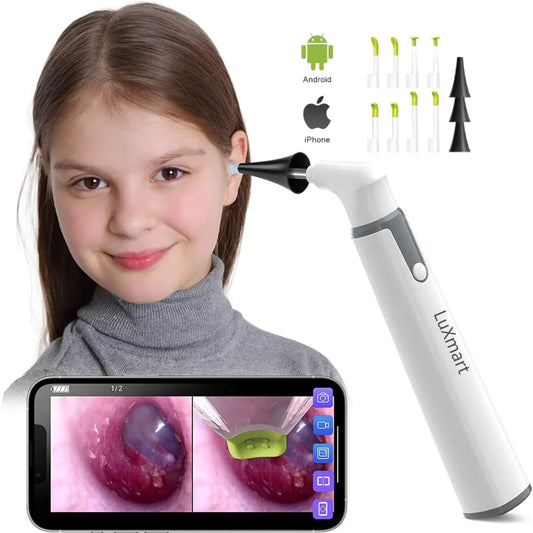 Explore Your Ears with the 3.9mm Wireless Otoscope Ear Camera - 720P HD WiFi Ear Scope with 6 LED, Perfect for Kids and Adults on Android and iPhone