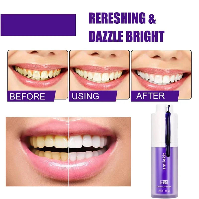 V34 SMILEKIT Purple Whitening Toothpaste - 30ml Stain Removal and Yellowing Reduction for Teeth and Gums, Fresh Breath and Brightening Care