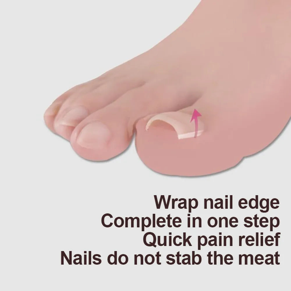 10pcs Ingrown Toenail Correction Tool - Elastic Patch Sticker, Ingrown Toe Nail Treatment, Straightening Clip Brace Pedicure Tool