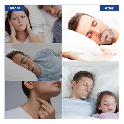 ELAIMEI Anti-Snoring Sleep Strips: Disposable Mouth Tape for Better Nose Breathing - Reduce Mouth Dryness and Sore Throat