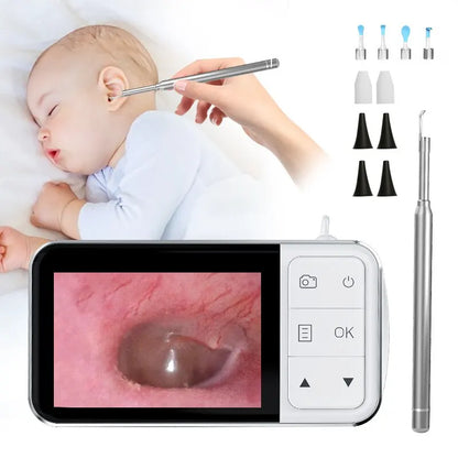 4.5 Inch LCD Digital Otoscope: 3.9mm 1080P Ear Scope Camera with 6 Lights - Ear Wax Removal Tool for Kids and Adults, Complete with Carrying Bag