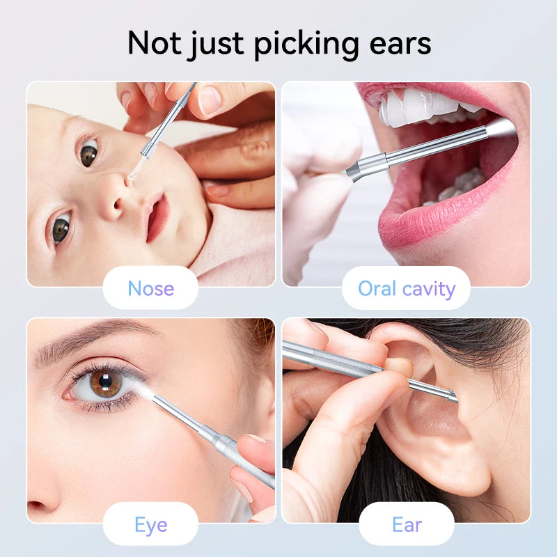 3.9mm Digital Otoscope: Smart Visual Ear Cleaning Tool with 4.3 Inch Display - 30MP Type-C, Connects to Computer, 2600mAh Battery