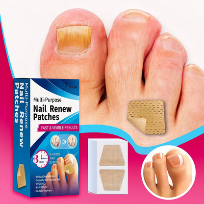 64 Piece Fungal Nail Patches – Extra Strength Toenail Fungus Treatment, Nail Repair and Renewal Patches for Damaged or Discolored Nails, Fast and Effective Care