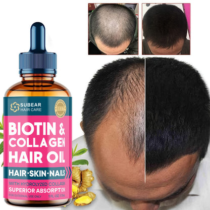 Biotin Hair Growth Serum - Thickening Oil for Thin, Damaged, and Frizzy Hair, Healthier Scalp for Men and Women, 1 Fl Oz